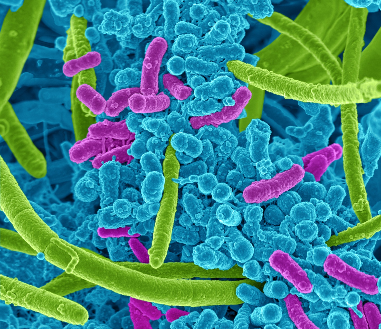 Electron scan of bacteria