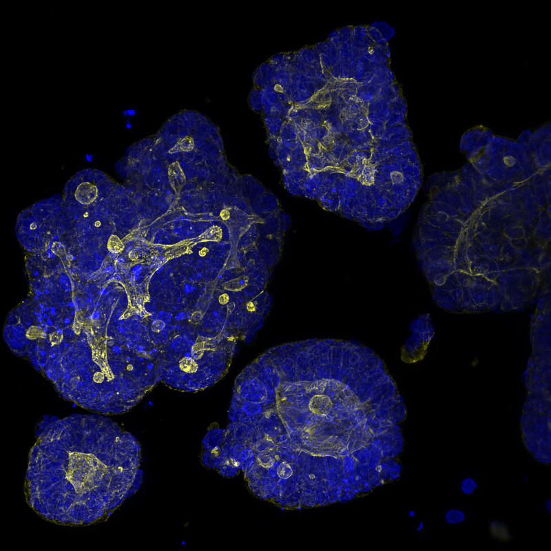 3D human-derived organoids