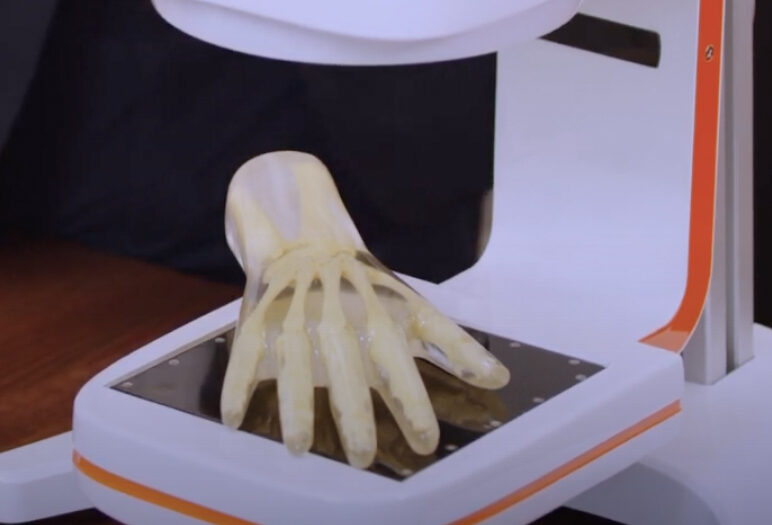 Low-cost portable 3D scans